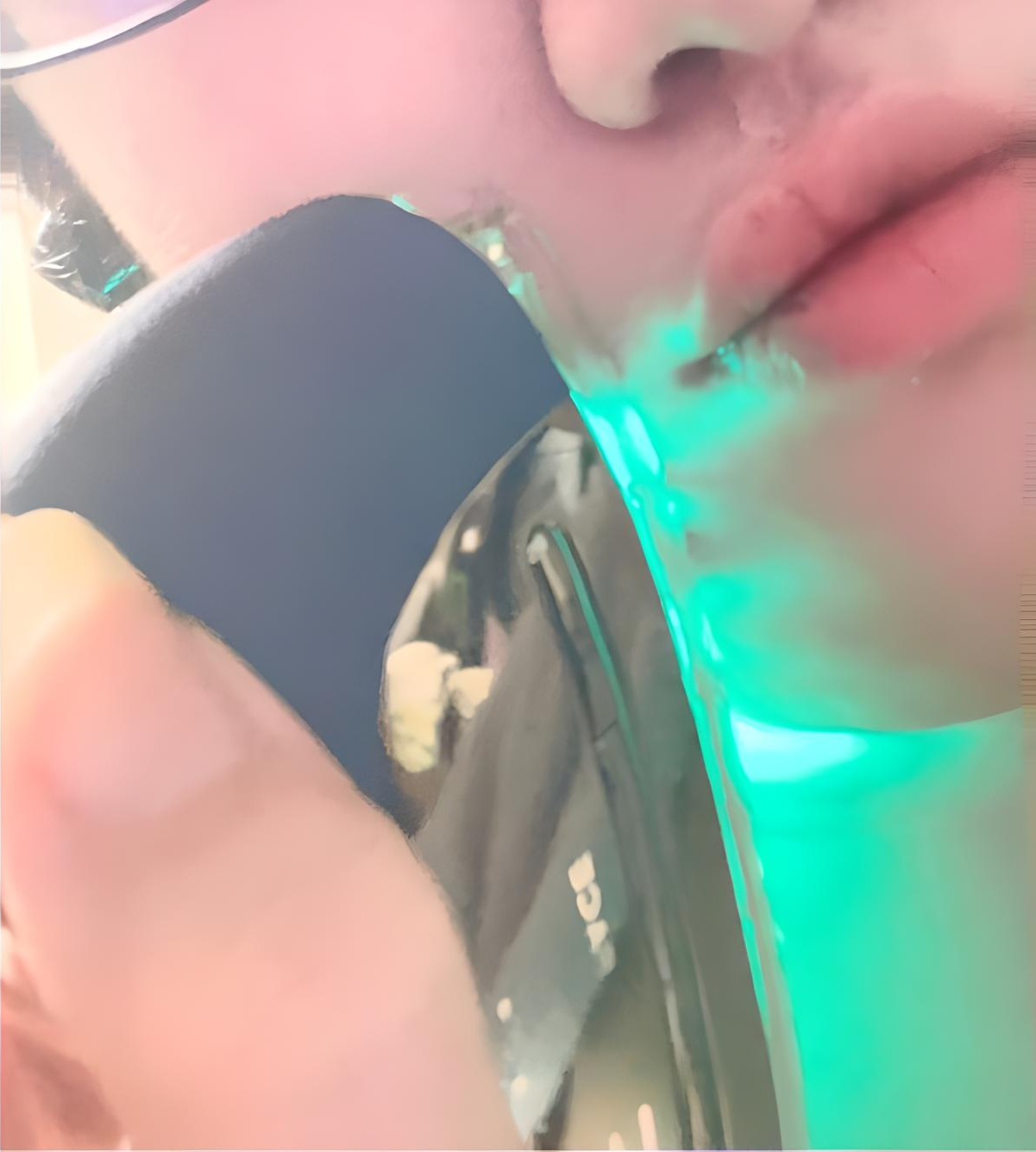 リフトロジーSP
